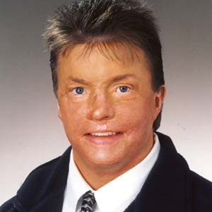 Beyer&nbsp;PT,&nbsp;Timothy