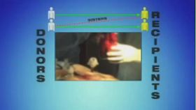 How Can a Multiple-Person Kidney Swap Be Achieved?