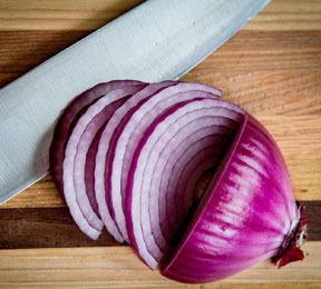 Stroke Prevention: An Onion a Day Stroke Prevention: An Onion a Day