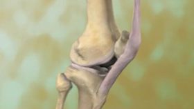 Do X-Rays Show Wearing Down of Cartilage Due to Arthritis?