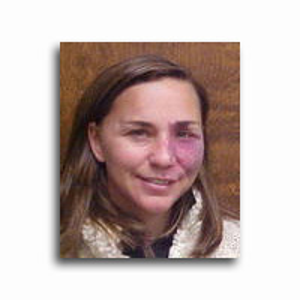 Dr. Linda L. Buckley, MD