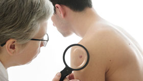 Stage 3 Basal Cell Carcinoma Stage 3 Basal Cell Carcinoma