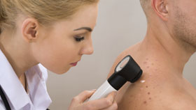 Stage 2 Basal Cell Carcinoma Stage 2 Basal Cell Carcinoma
