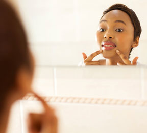 Avoiding Adult Acne Avoiding Adult Acne
