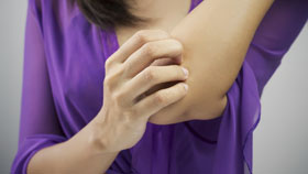 Cutaneous T-Cell Lymphoma Cutaneous T-Cell Lymphoma