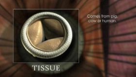 What Treatments Are Used for a Damaged Aortic Valve?