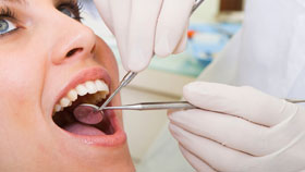 Tooth Enamel Erosion