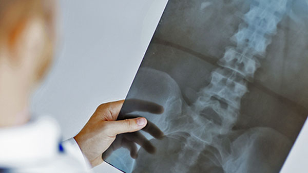 What Are the Risks Involved in Lumbar Microdiscectomy Surgery?