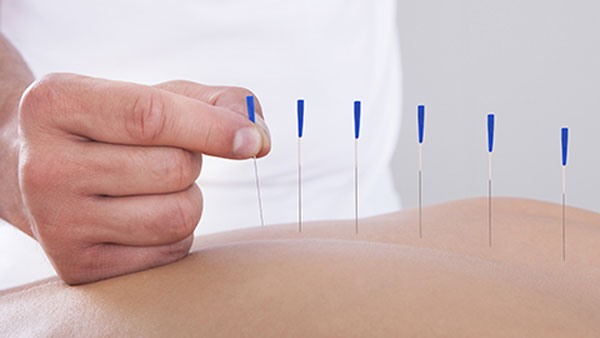 Are there Homeopathic or Alternative Ways to Treat Back Pain?