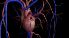Aortic Valve Stenosis