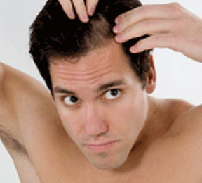 Causes of Hair Loss - How You Can Stop It Causes of Hair Loss - How You Can Stop It